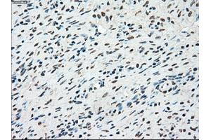 Immunohistochemical staining of paraffin-embedded colon tissue using anti-STK3mouse monoclonal antibody. (STK3 Antikörper)