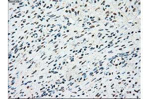 Immunohistochemical staining of paraffin-embedded colon tissue using anti-STK3mouse monoclonal antibody.