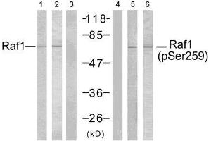 Western blot analysis using Raf-1 (Ab-259) antibody (E021006, Line 1, 2, and 3) and Raf-1 (phospho- Ser259) antibody (E011006, Line 4, 5, and 6). (RAF1 Antikörper  (pSer259))