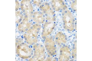 Immunohistochemistry of paraffin-embedded Rat kidney using C9orf114 Rabbit pAb (ABIN7266390) at dilution of 1:100 (40x lens).