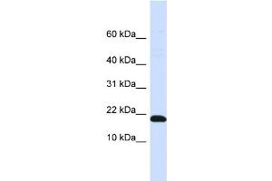 WB Suggested Anti-DNAJC25-GNG10 Antibody Titration:  0. (DNAJC25-GNG10 Antikörper  (N-Term))