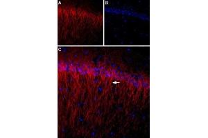 Expression of CACNB1 (CaVβ1) in rat hippocampus - Immunohistochemical staining of rat hippocampus using Anti-CACNB1 Antibody (ABIN7042984, ABIN7044049 and ABIN7044050). (CACNB1 Antikörper  (C-Term, Intracellular))