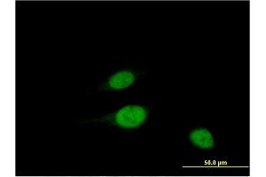 Immunofluorescence of monoclonal antibody to WBSCR22 on HeLa cell.