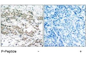 Image no. 1 for anti-Forkhead Box O4 (FOXO4) (pSer197) antibody (ABIN196850) (FOXO4 Antikörper  (pSer197))