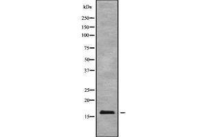 Western blot analysis of BTF3L4 using HT29 whole cell lysates (BTF3L4 Antikörper  (Internal Region))