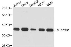 Western blot analysis of extracts of various cell lines, using MRPS31 antibody. (MRPS31 Antikörper)