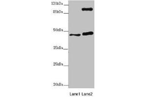 Western blot All lanes: AURKA antibody at 2 μg/mL Lane 1: NIH/3T3 whole cell lysate Lane 2: HT29 whole cell lysate Secondary Goat polyclonal to rabbit IgG at 1/10000 dilution Predicted band size: 46 kDa Observed band size: 46, 110 kDa (Aurora A Antikörper  (AA 1-131))