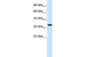 WB Suggested Anti-ZNF2 Antibody Titration:  1. (ZNF2 Antikörper  (N-Term))