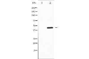 Western blot analysis of Tyrosine Hydroxylase phosphorylation expression in PC12 whole cell lysates,The lane on the left is treated with the antigen-specific peptide. (Tyrosine Hydroxylase Antikörper  (pSer19))