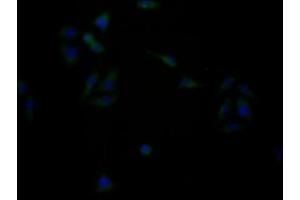 Immunofluorescence staining of HepG2 cells with ABIN7153367 at 1:133, counter-stained with DAPI.