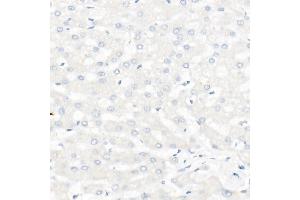 Immunohistochemistry (IHC) image for anti-Membrane-Spanning 4-Domains, Subfamily A, Member 1 (MS4A1) antibody (ABIN7268472)