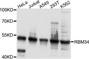 Western blot analysis of extracts of various cell lines, using RBM34 antibody. (RBM34 Antikörper)