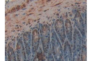 IHC-P analysis of Mouse Intestine Tissue, with DAB staining. (CPB2 Antikörper  (AA 113-422))