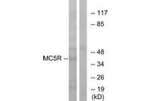 Western blot analysis of extracts from K562 cells, using MC5R Antibody. (MC5 Receptor Antikörper  (AA 271-320))