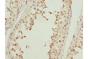 Immunohistochemistry of paraffin-embedded human testis tissue using ABIN7143059 at dilution of 1:100 (Actl7b Antikörper  (AA 1-415))