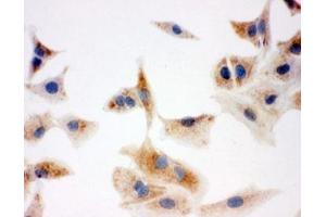 Immunocytochemistry (ICC) image for anti-Enoyl-CoA Delta Isomerase 1 (ECI1) (C-Term) antibody (ABIN3030698)