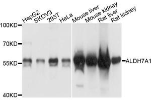 Western blot analysis of extracts of various cell lines, using ALDH7A1 antibody. (ALDH7A1 Antikörper)