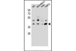 Western blot analysis in 293, MDA-MB231, Hela, HepG2 cell line lysates (35 mg/lane) using RRAGC Antibody (Center) Cat. (GTR2 Antikörper  (Middle Region))