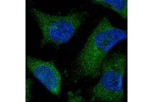 Immunofluorescent staining of human cell line U-251 MG with CISD2 polyclonal antibody  at 1-4 ug/mL dilution shows positivity in endoplasmic reticulum. (CISD2 Antikörper)