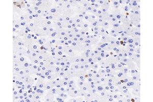 Immunohistochemistry analysis of paraffin-embedded human liver using MPO Polyclonal Antibody at dilution of 1:300.