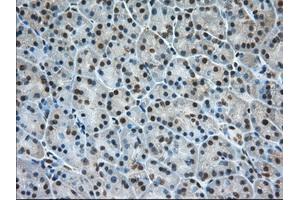 Immunohistochemical staining of paraffin-embedded Human Kidney tissue using anti-ERCC1 mouse monoclonal antibody. (ERCC1 Antikörper)