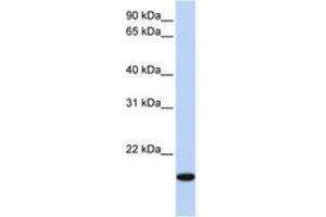 Image no. 1 for anti-Homeobox even-skipped homolog protein 2 (EVX2) (AA 154-203) antibody (ABIN6744266) (EVX2 Antikörper  (AA 154-203))