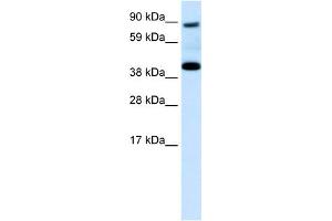 Western Blotting (WB) image for anti-serpin Peptidase Inhibitor, Clade F (Alpha-2 Antiplasmin, Pigment Epithelium Derived Factor), Member 1 (SERPINF1) (N-Term) antibody (ABIN2792309)