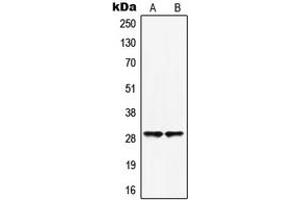 Western blot analysis of HOXB5 expression in HepG2 (A), HuvEc (B) whole cell lysates. (HOXB5 Antikörper  (Center))
