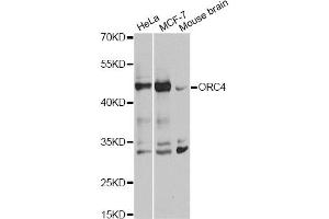 Western blot analysis of extracts of various cell lines, using ORC4 antibody. (ORC4 Antikörper)