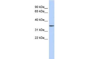 WB Suggested Anti-FBXO31 Antibody Titration: 0. (FBXO31 Antikörper  (Middle Region))