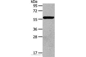Western blot analysis of Hela cell, using HDAC7 Polyclonal Antibody at dilution of 1:100 (HDAC7 Antikörper)