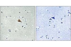 Immunohistochemistry analysis of paraffin-embedded human brain, using Trk A (Phospho-Tyr701) Antibody.