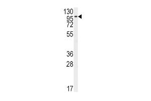 Western Blotting (WB) image for anti-Fibroblast Growth Factor Receptor 2 (FGFR2) (AA 7-37), (N-Term) antibody (ABIN391967)