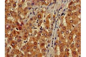 Immunohistochemistry of paraffin-embedded human liver tissue using ABIN7159786 at dilution of 1:100 (LC3C Antikörper  (AA 1-30))