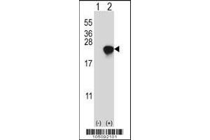 Western blot analysis of ARL2 using rabbit polyclonal ARL2 Antibody (D170) using 293 cell lysates (2 ug/lane) either nontransfected (Lane 1) or transiently transfected (Lane 2) with the ARL2 gene. (ARL2 Antikörper  (C-Term))