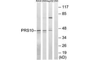 Western Blotting (WB) image for anti-Proteasome (Prosome, Macropain) 26S Subunit, ATPase, 6 (PSMC6) (AA 61-110) antibody (ABIN1534502)