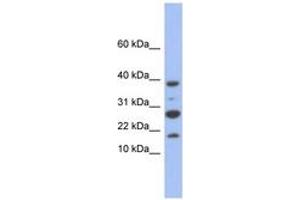 Image no. 1 for anti-NADH Dehydrogenase (Ubiquinone) 1, Subcomplex Unknown, 1, 6kDa (NDUFC1) (C-Term) antibody (ABIN6744061) (NDUFC1 Antikörper  (C-Term))