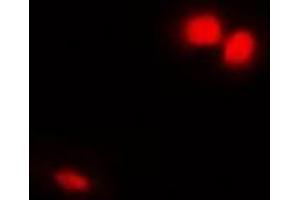 Immunofluorescent analysis of Emerin staining in Hela cells. (Emerin Antikörper)