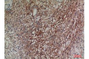 Immunohistochemistry (IHC) analysis of paraffin-embedded Human Brain, antibody was diluted at 1:100. (Neuregulin 2 Antikörper  (Internal Region))