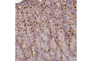 Immunohistochemical staining of human stomach with AGXT2L1 polyclonal antibody  shows distinct nuclear and cytoplasmic positivity in glandular cells. (AGXT2L1 Antikörper)