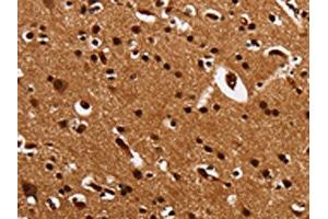 The image is immunohistochemistry of paraffin-embedded Human brain tissue using ABIN7131549(UPK3B Antibody) at dilution 1/25. (Uroplakin 3B Antikörper)