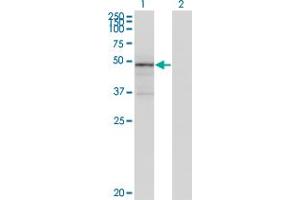 Western Blot analysis of TNXB expression in transfected 293T cell line by TNXB monoclonal antibody (M01), clone 2D3-1B10. (TNXB Antikörper  (AA 1-673))