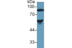 Detection of AT in Human Serum using Polyclonal Antibody to Antithrombin (AT) (SERPINC1 Antikörper  (AA 150-426))