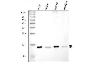 Western blot analysis of Prealbumin using anti-Prealbumin antibody (ABIN3042346). (TTR Antikörper  (AA 21-147))