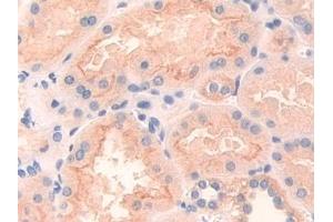 Immunohistochemistry (IHC) image for anti-Protein tyrosine Phosphatase, Receptor Type, J (PTPRJ) (AA 1061-1293) antibody (ABIN7440614)