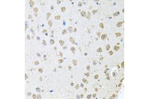 Immunohistochemistry of paraffin-embedded mouse brain using TARS antibody (ABIN5974207) at dilution of 1/100 (40x lens). (TARS Antikörper)