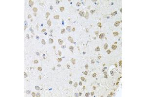 Immunohistochemistry of paraffin-embedded mouse brain using TARS antibody (ABIN5974207) at dilution of 1/100 (40x lens).