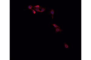 ABIN6266714 staining Hep G2 cells by IF/ICC. (MED14 Antikörper  (Internal Region))