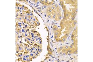 Immunohistochemistry of paraffin-embedded human kidney using USO1 antibody (ABIN1875291) at dilution of 1:200 (40x lens). (USO1 Antikörper)