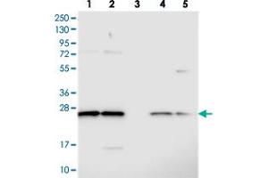 Western blot analysis of Lane 1: RT-4, Lane 2: U-251 MG, Lane 3: Human Plasma, Lane 4: Liver, Lane 5: Tonsil with C14orf166 polyclonal antibody  at 1:250-1:500 dilution. (C14orf166 Antikörper)